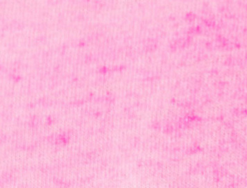 Hot Fuschia